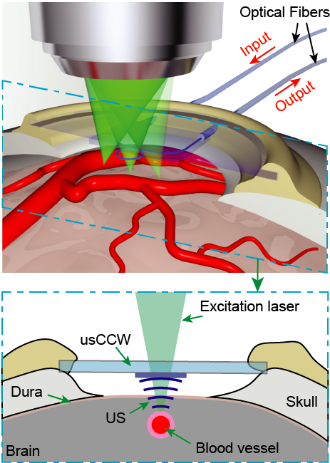 usCCW